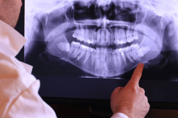 Best Same-Day Emergency Dental Services in Island Lake, IL