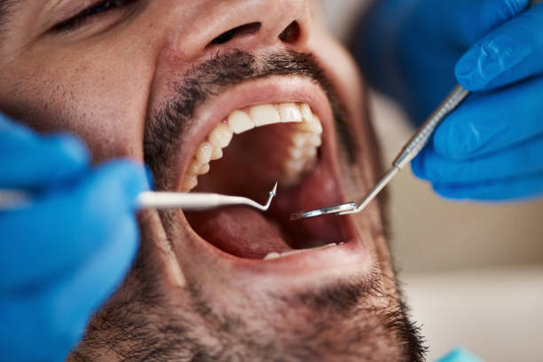 Best Emergency Orthodontic Services in Island Lake, IL