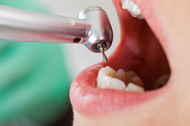 Best Pediatric Emergency Dentist in Island Lake, IL